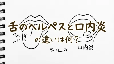 舌のヘルペスと口内炎の違いは何？