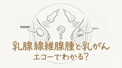 乳腺線維腺腫と乳がんの違いはエコーでわかる？