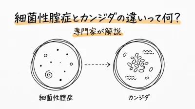 細菌性腟症とカンジダの違いって何？