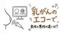 乳がんのエコーで良性と悪性の違いは？