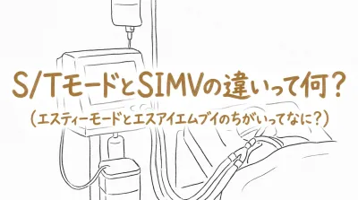 S/TモードとSIMVの違いって何？