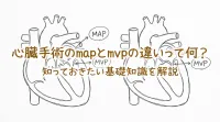 心臓手術のmapとmvpの違いって何？