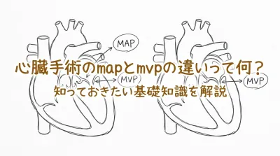 心臓手術のmapとmvpの違いって何？