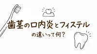 歯茎の口内炎とフィステルの違いって何？