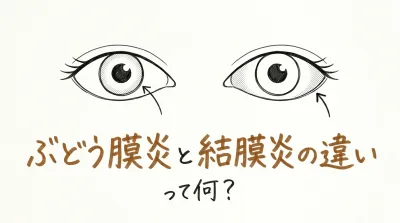 ぶどう膜炎と結膜炎の違いって何？