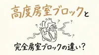 高度房室ブロックと完全房室ブロックの違い？