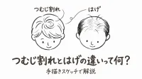 つむじ割れとはげの違いって何？