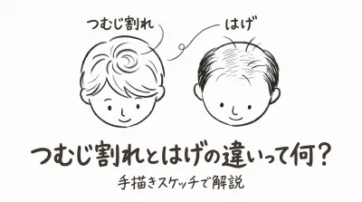 つむじ割れとはげの違いって何？