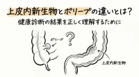 上皮内新生物とポリープの違いとは？