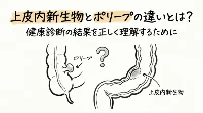 上皮内新生物とポリープの違いとは？